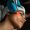 microneedling